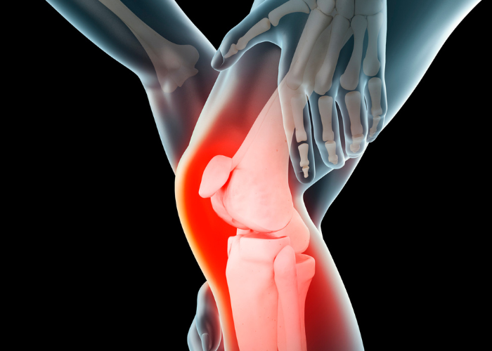 Knee Pain-2