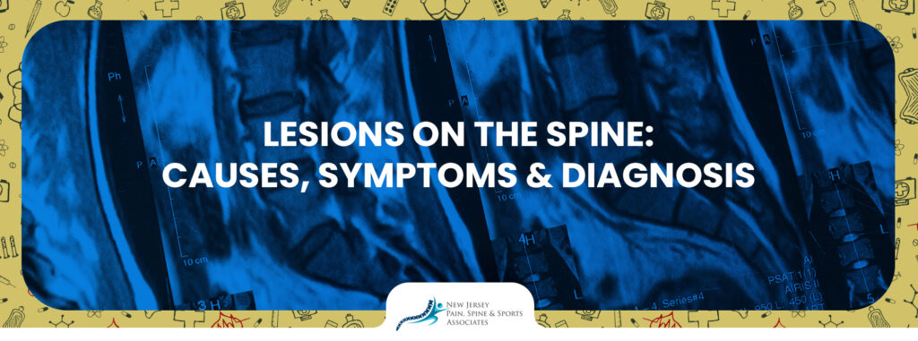 Lesions on the Spine: Causes, Symptoms & Diagnosis